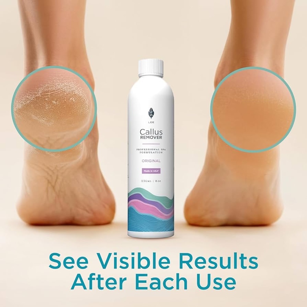 New Lee Beauty 8oz Professional Gel Callus Remover For Feet